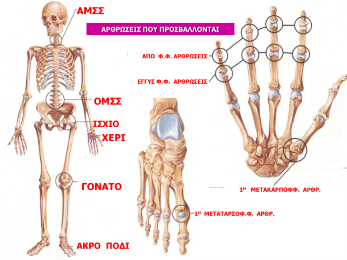 THERAPEIA