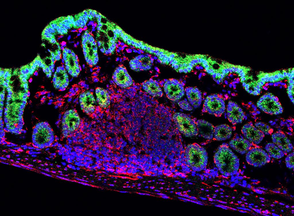 MIKROBIOMA MESA 1