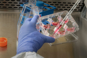 EFPIA: Ευπρόσδεκτο βήμα προς τα εμπρός η στρατηγική της ΕΕ για τις βιοεπιστήμες