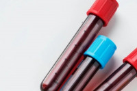 Επιστήμονες φιλοδοξούν μέσω τεστ αίματος να προβλέπουν την πορεία ασθενή με COVID-19