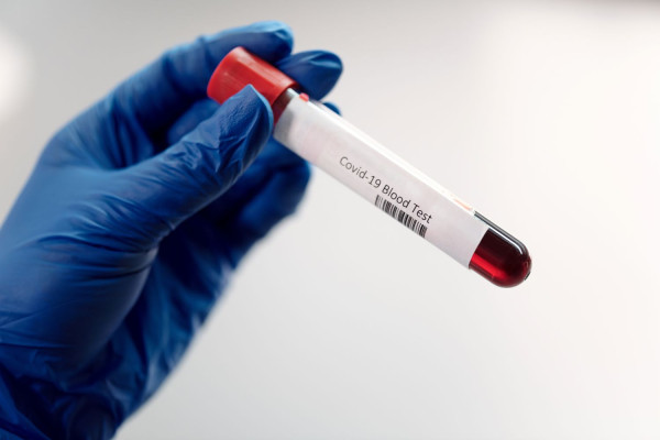 Βιοδείκτες αίματος προσδιορίζουν επακριβώς τους ασθενείς με long Covid