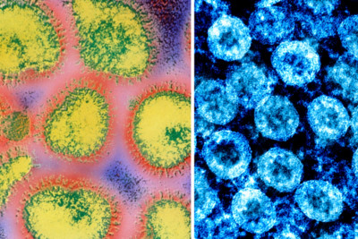 «Η γρίπη είναι πιο θανατηφόρα από τον COVID-19»: Ένας μύθος που καταρρίφθηκε