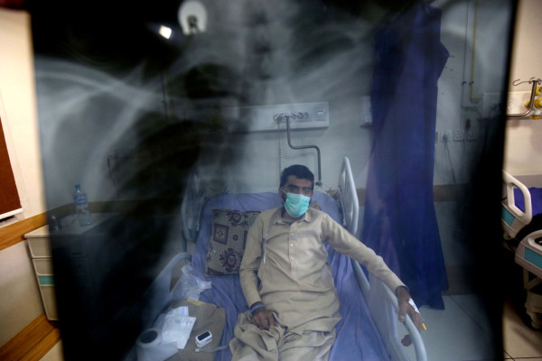 Γιατί «θερίζει» η φυματίωση - Ο ρόλος των πνευμονολόγων σ&#039; ένα οξύ ζήτημα δημόσιας υγείας