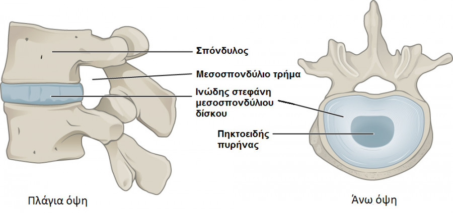 Έτσι αντιμετωπίζεται η κήλη μεσοσπονδυλίου δίσκου χωρίς εγχείρηση