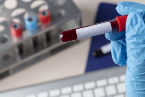 Καρκίνος τραχήλου- κεφαλής από τον ιό HPV: Απλή εξέταση αίματος τον εντοπίζει 10 χρόνια πριν τα συμπτώματα