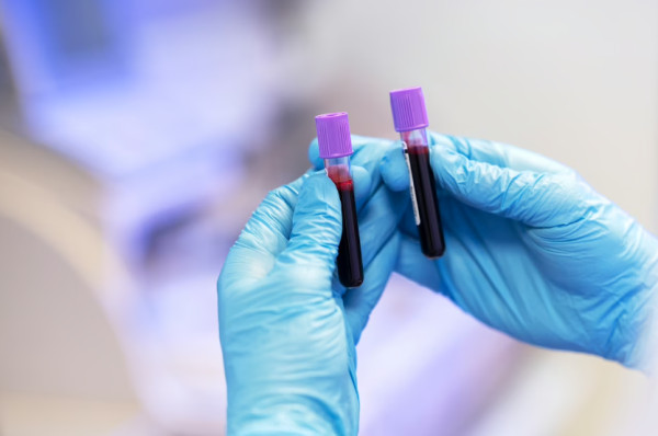 Νέα έρευνα: Τα άτομα με αυτή την ομάδα αίματος κολλάνε πιο εύκολα κορονοϊό