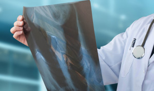 Πνευμονικός Όζος: Θεωρείται «ύποπτος» για κακοήθεια; Αυτές τις εξετάσεις πρέπει να κάνετε