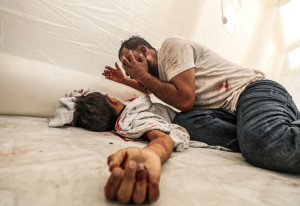 Τα ακρωτηριασμένα παιδιά της Γάζας προκαλούν ρίγη συγκίνησης: «Ξαναβάλτε μου τα πόδια μου»
