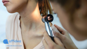 Δερματοσκόπηση σπίλων: Η εξέταση-κλειδί για την έγκαιρη ανίχνευση του καρκίνου του δέρματος