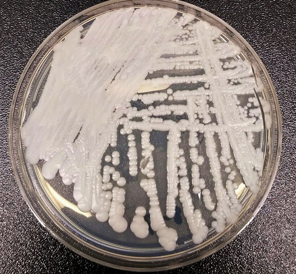 Candida auris: Τα συμπτώματα που προκαλεί ο μύκητας που «χτυπά» στα νοσοκομεία και η θεραπεία που τα «ανακουφίζει»