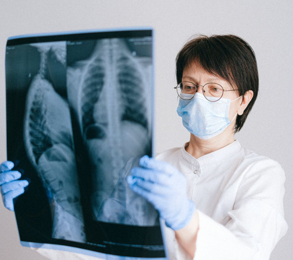 ESMO 2023: Ανακοινώθηκαν νέες μελέτες για τη θεραπεία του καρκίνου του πνεύμονα