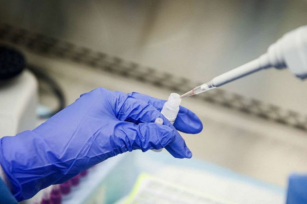 Κορονοϊός: Διαγνωστικό τεστ ανιχνεύει τον ιό σε χρόνο ρεκόρ