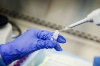 Κορονοϊός: Διαγνωστικό τεστ ανιχνεύει τον ιό σε χρόνο ρεκόρ
