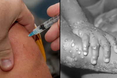 Εθνική Επιτροπή Εμβολιασμών: Σε ποιους συστήνει να εμβολιαστούν κατά της ευλογιάς των πιθήκων