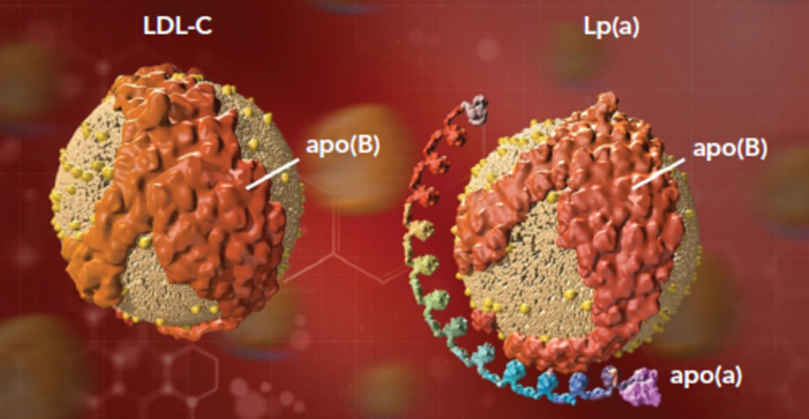 Lp(a) χοληστερόλη: Όχι και τόσο «κακή» τελικά; Καρδιολόγος εξηγεί