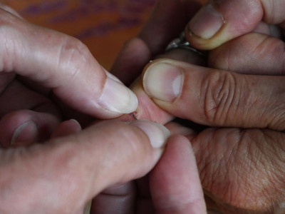 Πώς αφαιρούμε το θραύσμα που μπήκε στο δέρμα ή τα νύχια μας