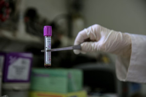 Ραγδαία αύξηση κρουσμάτων HIV και κατάσταση εθνικής κρίσης στα νησιά Φίτζι