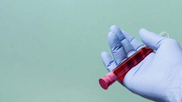 Απλή εξέταση αίματος καταφέρνει υψηλά ποσοστά ακρίβειας στην ανίχνευση καρκίνων και άλλων ασθενειών