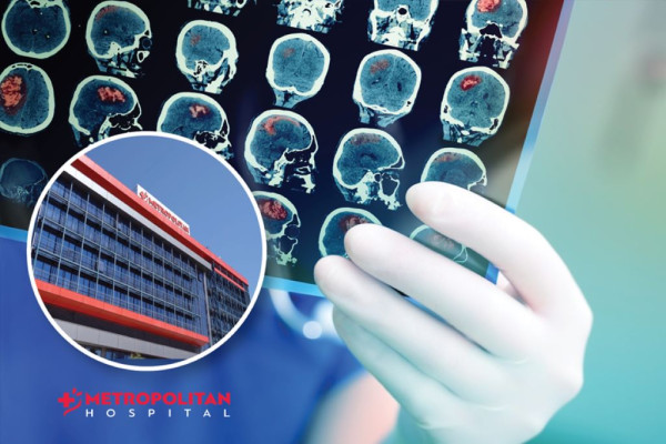 Τεχνητή νοημοσύνη για την αντιμετώπιση εγκεφαλικών επεισοδίων στο Metropolitan Hospital