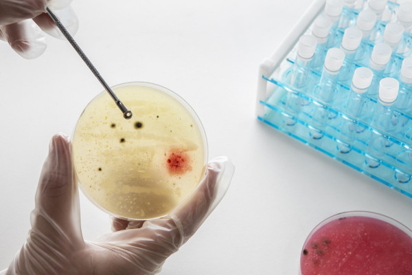 Ερευνητές της Mayo Clinic αναζητούν στα κόπρανα το μυστικό για εξατομικευμένη αντιμετώπιση του καρκίνου
