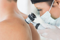 Καρκίνος του δέρματος: Ελπίδες για ανάπτυξη εμβολίου