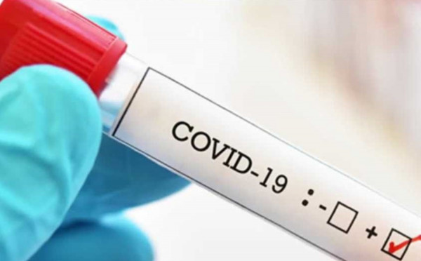 CDC: Συστήνει συστηματικό έλεγχο για COVID-19 σε κλειστές δομές και ειδικά σε δομές φιλοξενίας αστέγων