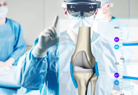 Οστεοαρθρίτιδα γόνατος: Οι σύγχρονες τεχνικές αντιμετώπισης της - Πόσο αποτελεσματικές είναι