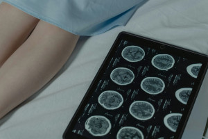 Νευροενδοκρινείς Όγκοι: Έγκαιρη διάγνωση, κατάλληλη θεραπευτική αντιμετώπιση