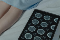 Long Covid: Πώς επιδρά στον εγκέφαλο - Νέα δεδομένα για τις επιδράσεις της νόσου