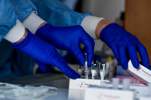 ΕΟΔΥ: Δωρεάν rapid tests και δράσεις ενημέρωσης για HIV και ΣΜΝ σε όλη την Ελλάδα