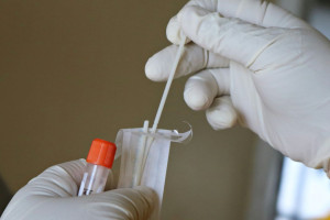 ΕΚΟΓΙ: Τα τεστ DNA στην πρόληψη καρδιαγγειακών παθήσεων και την εξατομικευμένη διατροφή