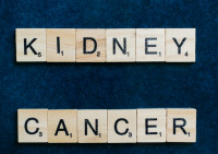 Καρκίνος του νεφρού: Τι πρέπει να γνωρίζει ο ασθενής για τις θεραπευτικές επιλογές της «σιωπηλής» ασθένειας