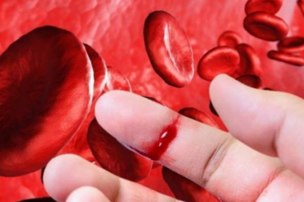 Αιμορροφιλία: Μία σπάνια διαταραχή της πήξης του αίματος