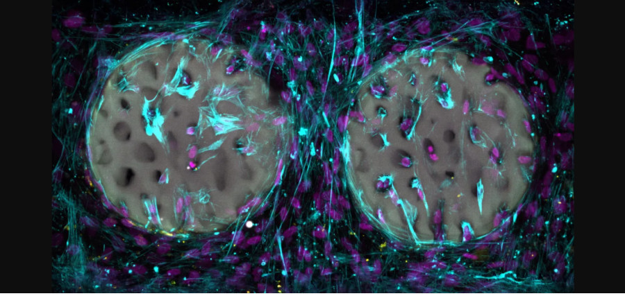 Xiao-Shua Qin / ETH Zurich