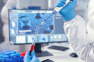 ΕΟΠΕ: «Καθυστέρηση στην εφαρμογή του νέου πλαισίου για τους βιοδείκτες»