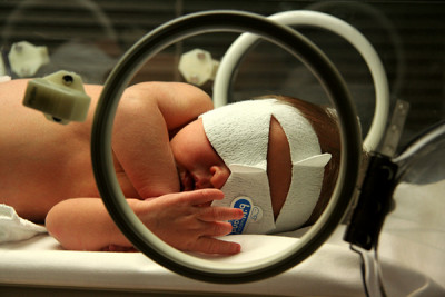 Νέα εφαρμογή κινητού «σκανάρει» τα νεογέννητα και εντοπίζει με επιτυχία τον ίκτερο