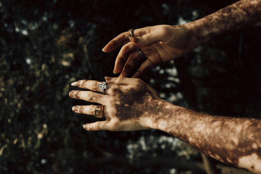 UNSPLASH 