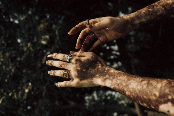 UNSPLASH 