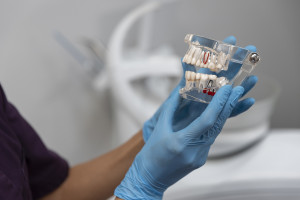 Τα οδοντικά εμφυτεύματα απελευθερώνουν σωματίδια τιτανίου στο στόμα - Η αλληλεπίδραση με γονίδια