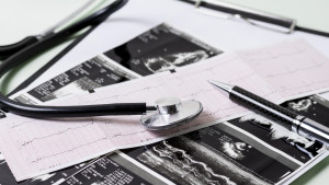 Lancet: Οι θάνατοι από χρόνιες ασθένειες έχουν μειωθεί κατά 80% παγκοσμίως