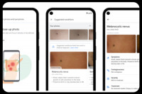 Διαδικτυακή εφαρμογή της Google θα απαντάει στα δερματολογικά σου ερωτήματα