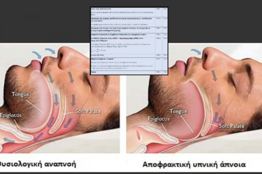Ο ύπνος σώζει ζωές: Ερωτηματολόγιο της ΕΠΕ για την ανίχνευση της Αποφρακτικής Υπνικής Άπνοιας