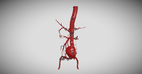 safe-aorta.gr