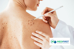 Πολυϊατρείο Medifirst Περιστερίου: Χαρτογράφηση σπίλων με νέο μη επεμβατικό εξοπλισμό υψηλής τεχνολογίας