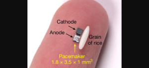 Ο μικροσκοπικός βηματοδότης που μπορεί να φέρει επανάσταση στην καρδιοχειρουργική