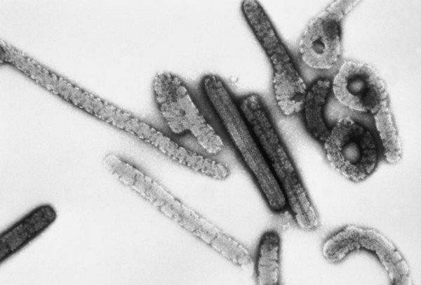 ΠΟΥ για ιό Μάρμπουργκ: Εξαιρετικά μεταδοτικός ο «συγγενής» του Έμπολα, 2 νεκροί στην Γκάνα