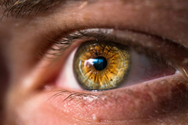 Πρησμένα μάτια: Όταν το πρόβλημα δεν είναι απλώς αισθητικό - Τι πρέπει να προσέχετε