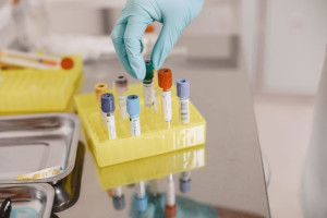 Σε επιφυλακή το ECDC για το περιστατικό στη Σιβηρία με την υποψία πνευμονικής πανώλης