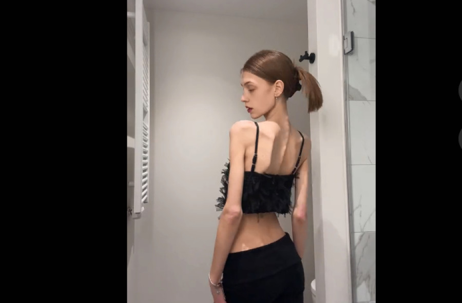 Skinnytok: η ιντερνετική πρόκληση που απειλεί τους νέους - Σχετική ερώτηση του Τσιόδρα στην Κομισιόν