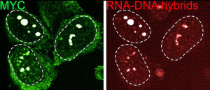 Ερευνητές "ξεσκέπασαν" το μηχανισμό με τον οποίο τα καρκινικά κύτταρα κρύβονται από το ανοσοποιητικό